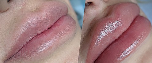 Micropigmentación de labios en Avilés