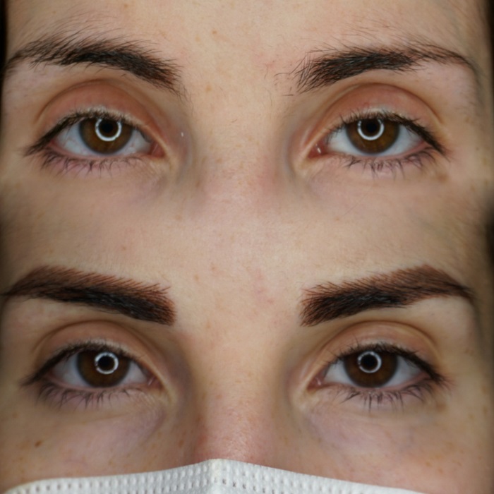 Microblading Gijon Resultado Natural microblading gijon resultado natural