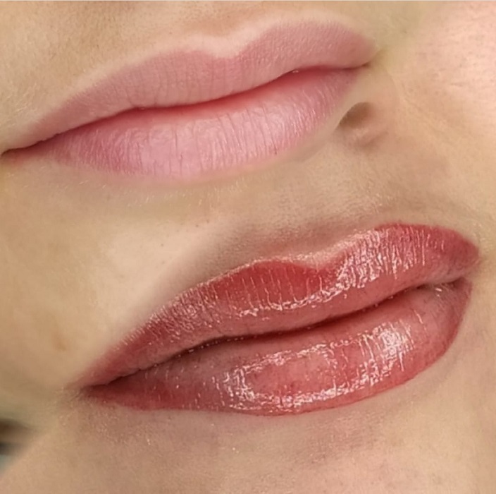 Coloracion De Labios Asturias Resultado Natural coloracion de labios asturias resultado natural